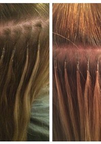  Коррекция капсульного наращивания (М20196)